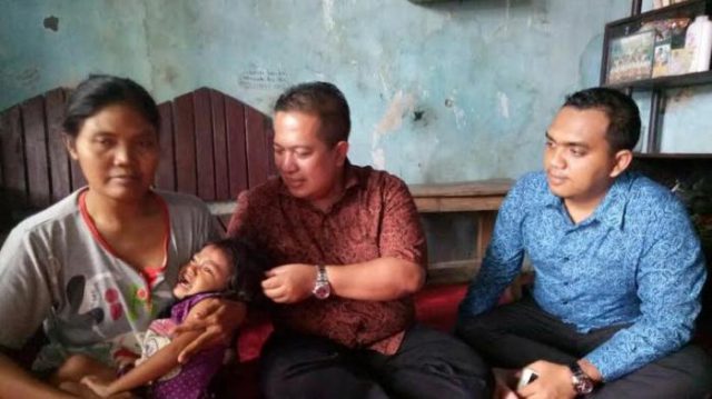 Anggota Komisi VI DPR RI Jateng X Fraksi PAN, Andriyanto Johan Syah, menyambangi kediaman bocah penderita kelainan tulang punggung, Khoirul Maghfiroh (3) putri pasangan Sundari (38) -Munis Tamarun (alm) di RT 03 RW 01 Desa Iser, Kecamatan Petarukan, Kabupaten Pemalang.